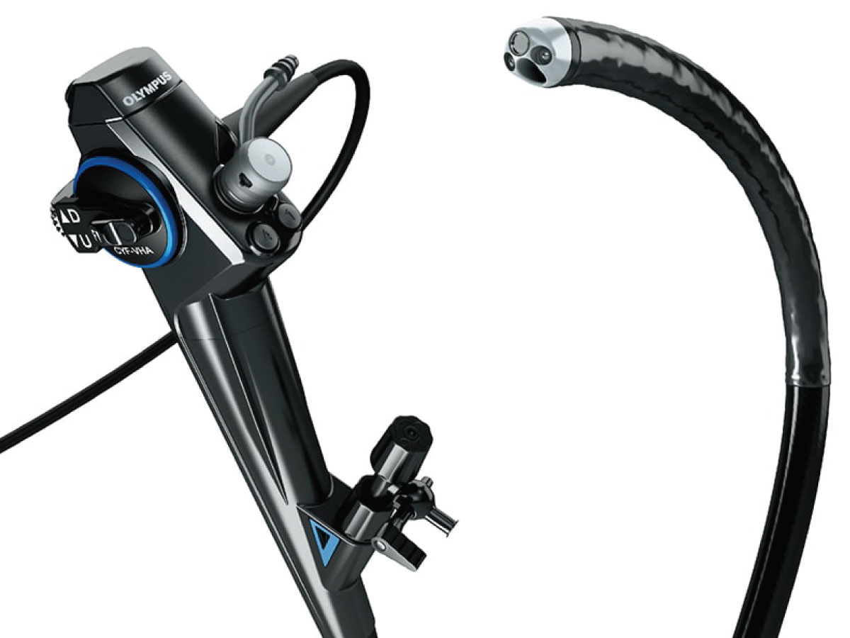 内視鏡(膀胱鏡)検査