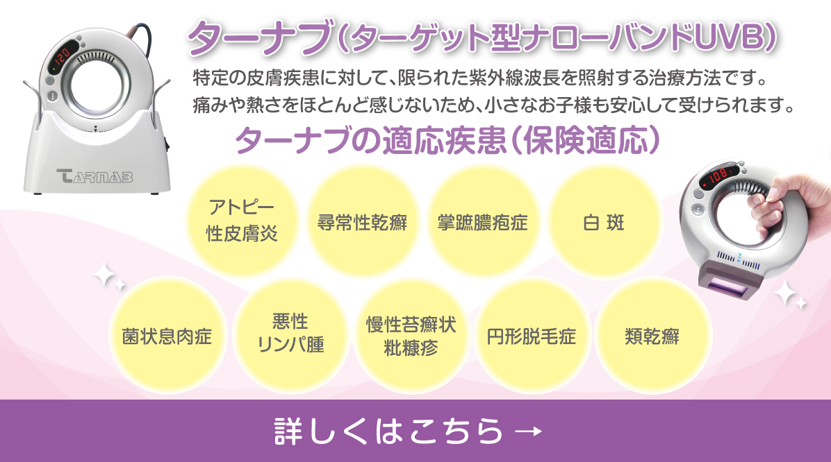 ターナブ